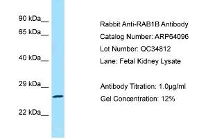 Western Blotting (WB) image for anti-RAB1B, Member RAS Oncogene Family (RAB1B) (C-Term) antibody (ABIN971512) (RAB1B antibody  (C-Term))