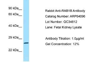 Western Blotting (WB) image for anti-RAB1B, Member RAS Oncogene Family (RAB1B) (C-Term) antibody (ABIN2774390) (RAB1B antibody  (C-Term))