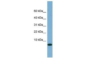 FABP1 antibody used at 1 ug/ml to detect target protein. (FABP1 antibody  (N-Term))