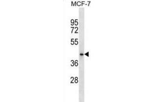 Western Blotting (WB) image for anti-HAUS Augmin-Like Complex, Subunit 7 (HAUS7) antibody (ABIN2999609)