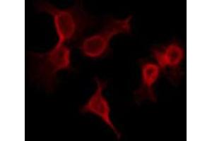 ABIN6266770 staining LOVO by IF/ICC. (ADNP antibody  (N-Term))