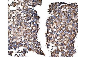 IHC analysis of Paxillin/PXN using anti-Paxillin/PXN antibody (ABIN7602636). (Paxillin antibody  (AA 9-570))