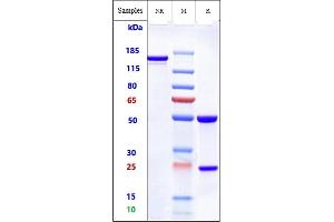 Anti-ROR2 Reference Antibody (Ozuriftamab) on SDS-PAGE under reducing (R) condition. (Recombinant ROR2 (Ozuriftamab Biosimilar) antibody)