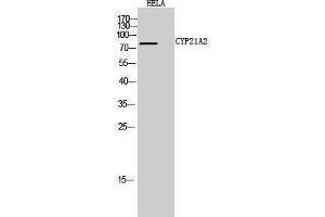 Western Blotting (WB) image for anti-Cytochrome P450, Family 21, Subfamily A, Polypeptide 2 (CYP21A2) (Internal Region) antibody (ABIN3184166) (CYP21A2 antibody  (Internal Region))