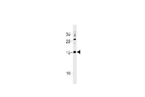 SSNA1 Antibody (N-term) (ABIN1881836 and ABIN2843441) western blot analysis in  cell line lysates (35 μg/lane). (SSNA1 antibody  (N-Term))