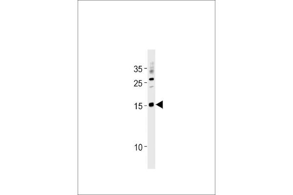 SSNA1 antibody  (N-Term)