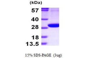 SDS-PAGE (SDS) image for 6-phosphogluconolactonase (PGLS) (AA 1-258) protein (His tag) (ABIN667246)