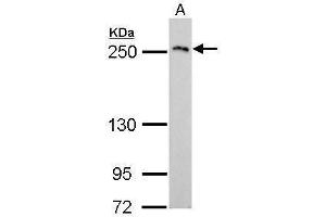 WB Image COL3A1 antibody [C2C3], C-term detects COL3A1 protein by Western blot analysis. (COL3A1 antibody  (C-Term))
