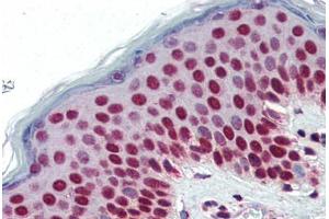Human Skin (formalin-fixed, paraffin-embedded) stained with SETD7 antibody ABIN364315 at 5 ug/ml followed by biotinylated anti-mouse IgG secondary antibody ABIN481714, alkaline phosphatase-streptavidin and chromogen.