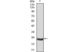 Western blot analysis using PKHD1 mAb against mouse PKHD1(AA: 3878-4060) recombinant protein. (PKHD1 antibody  (AA 3878-4060))