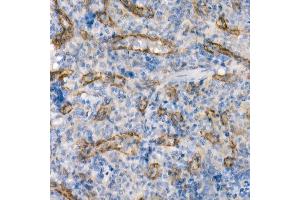 Immunohistochemistry of paraffin-embedded rat spleen using eNOS Rabbit mAb (ABIN7268920) at dilution of 1:200 (40x lens). (ENOS antibody)