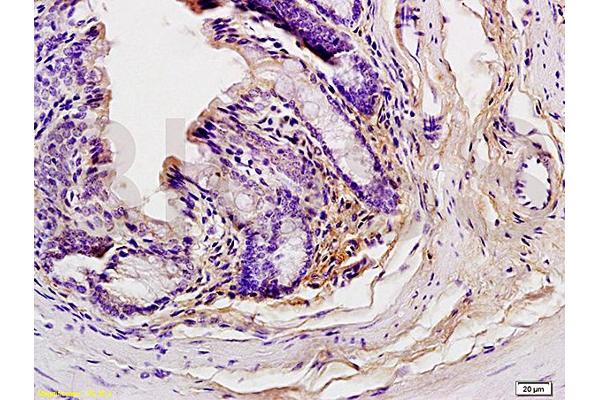 GCN2 antibody  (pThr899)