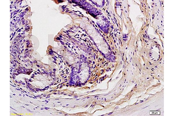 GCN2 antibody  (pThr899)