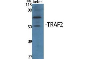 Western Blotting (WB) image for anti-TNF Receptor-Associated Factor 2 (TRAF2) (Internal Region) antibody (ABIN3177779) (TRAF2 antibody  (Internal Region))