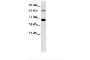 Image no. 2 for anti-Glutamate Receptor, Ionotropic, Kainate 2 (GRIK2) (AA 151-200) antibody (ABIN202320) (GRIK2 antibody  (AA 151-200))