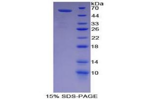 SDS-PAGE analysis of Pig Lipase, Hepatic Protein. (LIPC Protein)