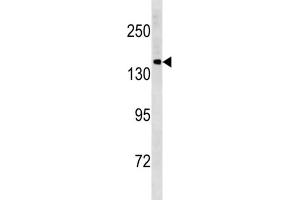 Western Blotting (WB) image for anti-Protocadherin 11 Y-Linked (PCDH11Y) antibody (ABIN3004496) (PCDH11Y antibody)