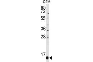 Western Blotting (WB) image for anti-Prefoldin Subunit 6 (PFDN6) antibody (ABIN3001660)