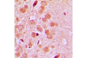 Immunohistochemical analysis of CD75 staining in human brain formalin fixed paraffin embedded tissue section. (ST6GAL1 antibody  (Center))