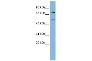 GFPT2 antibody used at 1 ug/ml to detect target protein. (GFPT2 antibody  (Middle Region))