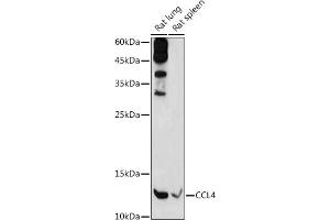 Western blot analysis of extracts of various cell lines, using CCL4 antibody (ABIN3022366, ABIN3022367, ABIN3022368 and ABIN6218763) at 1:1000 dilution. (CCL4 antibody  (C-Term))