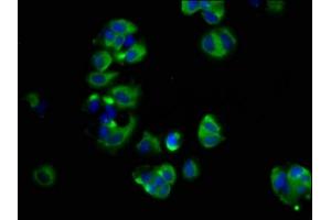 Immunofluorescence staining of MCF-7 cells with ABIN7166124 at 1:66, counter-stained with DAPI. (SHROOM2 antibody  (AA 213-405))