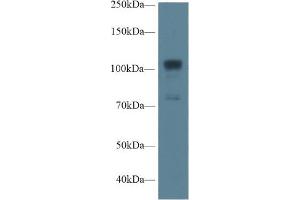 Western blot analysis of Human A549 cell lysate, using Rat NOS1 Antibody (1 µg/ml) and HRP-conjugated Goat Anti-Rabbit antibody ( (NOS1 antibody  (AA 468-616))