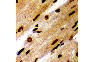 Immunohistochemical analysis of PSMB1 staining in mouse heart formalin fixed paraffin embedded tissue section.
