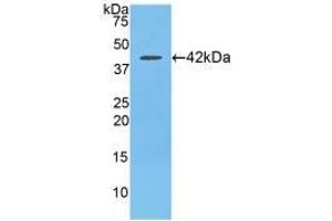 Western blot analysis of recombinant Rat SLC. (CCL21 antibody  (AA 5-132))