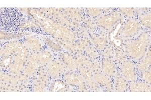 Detection of STC1 in Human Kidney Tissue using Polyclonal Antibody to Stanniocalcin 1 (STC1) (Stanniocalcin 1 antibody  (AA 28-247))