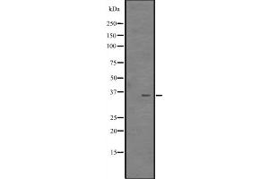Western blot analysis of CITED4 expression in MCF7 Cell Lysate ,The lane on the left is treated with the antigen-specific peptide. (CITED4 antibody  (Internal Region))