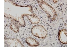 Immunoperoxidase of monoclonal antibody to ISGF3G on formalin-fixed paraffin-embedded human prostate. (IRF9 antibody  (AA 1-393))