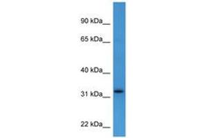 Image no. 1 for anti-Docking Protein 4 (DOK4) (C-Term) antibody (ABIN6746785) (DOK4 antibody  (C-Term))