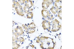 Immunohistochemistry of paraffin-embedded human gastric using RBP2 antibody at dilution of 1:100 (x40 lens). (RBP2 antibody)