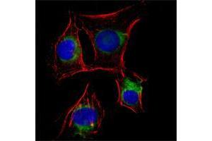 Immunofluorescence analysis of EC cells using NGFR mouse mAb (green). (NGFR antibody)