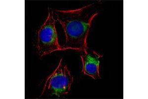 Immunofluorescence analysis of EC cells using NGFR mouse mAb (green).