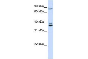 C18ORF10 antibody used at 1 ug/ml to detect target protein.
