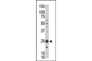 Western Blotting (WB) image for anti-Melanoma Antigen Family H, 1 (MAGEH1) (C-Term) antibody (ABIN358661) (MAGEH1 antibody  (C-Term))