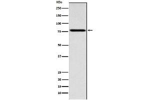 Western blot analysis of Coilin expression in Jurkat cell lysate.