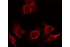 ABIN6278359 staining SW480 cells by ICC/IF. (MUC2 antibody)