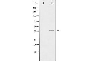 Western Blotting (WB) image for anti-Nuclear Factor of kappa Light Polypeptide Gene Enhancer in B-Cells Inhibitor, alpha (NFKBIA) (pTyr305) antibody (ABIN6255877)