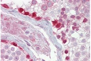 Anti-CRY1 antibody IHC staining of human testis. (CRY1 antibody  (AA 151-200))