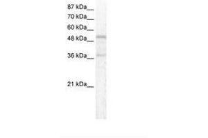 Image no. 1 for anti-Forkhead Box C1 (FOXC1) (AA 406-455) antibody (ABIN202753) (FOXC1 antibody  (AA 406-455))