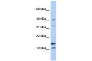 Image no. 1 for anti-WAP Four-Disulfide Core Domain 5 (WFDC5) (N-Term) antibody (ABIN6743675) (WFDC5 antibody  (N-Term))