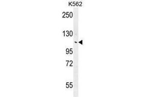 ANKRD18B Antibody (N-term) western blot analysis in K562 cell line lysates (35µg/lane). (ANKRD18B antibody  (N-Term))