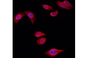 ABIN6258722 and ABIN6274757 staining Hela by IF/ICC.