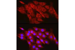 Immunofluorescence analysis of PC-12 cells using CPT2 Rabbit pAb (ABIN6129249, ABIN6138983, ABIN6138984 and ABIN6216045) at dilution of 1:100 (40x lens). (CPT2 antibody  (AA 1-180))