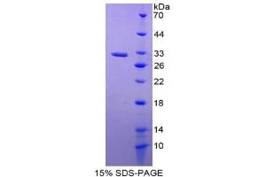 SDS-PAGE (SDS) image for Prostaglandin-Endoperoxide Synthase 1 (Prostaglandin G/H Synthase and Cyclooxygenase) (PTGS1) (AA 367-599) protein (His tag) (ABIN2126453)