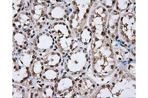 Immunohistochemical staining of paraffin-embedded lung tissue using anti-DAPK2 mouse monoclonal antibody.