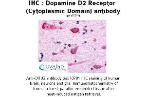 Image no. 1 for anti-Dopamine Receptor D2 (DRD2) (3rd Cytoplasmic Domain) antibody (ABIN1733733) (Dopamine d2 Receptor antibody  (3rd Cytoplasmic Domain))